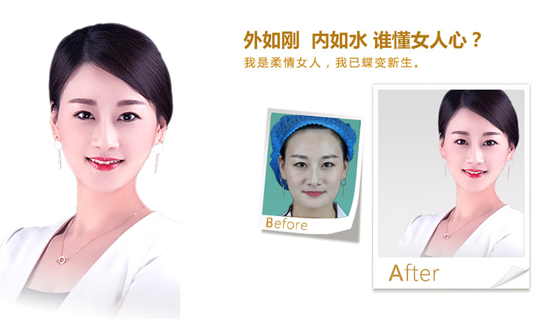 营口V脸、线雕隆鼻
